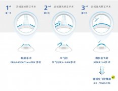 衡水同瑞眼科：微创全飞秒精准 4.0 - VISULYZE，让近视患者重获清晰视界